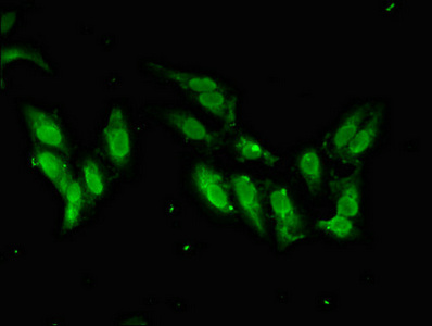 Immunocytochemistry/ Immunofluorescence - Anti-SmarcAL1 antibody (AB236786)