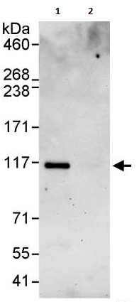 Immunoprecipitation - Anti-SmarcAL1 antibody (AB240605)