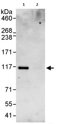 Immunoprecipitation - Anti-SmarcAL1 antibody (AB240605)