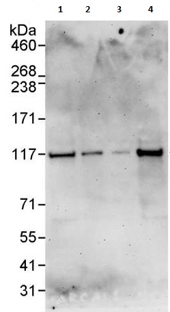 Western blot - Anti-SmarcAL1 antibody (AB240605)