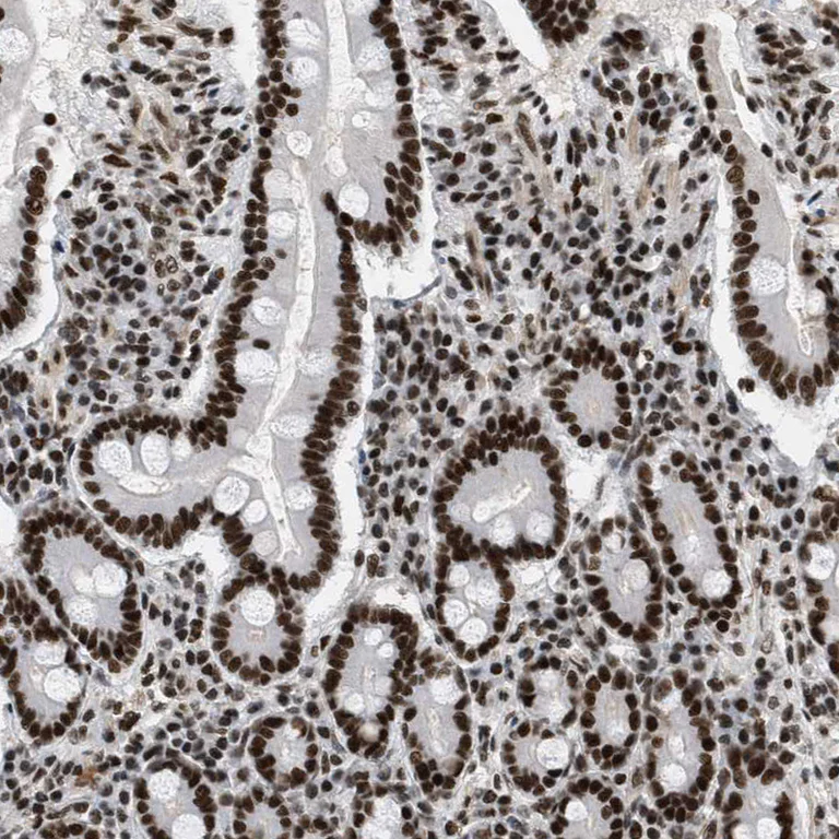 Immunohistochemistry (Formalin/PFA-fixed paraffin-embedded sections) - Anti-SMARCB1 Antibody (AB327193)