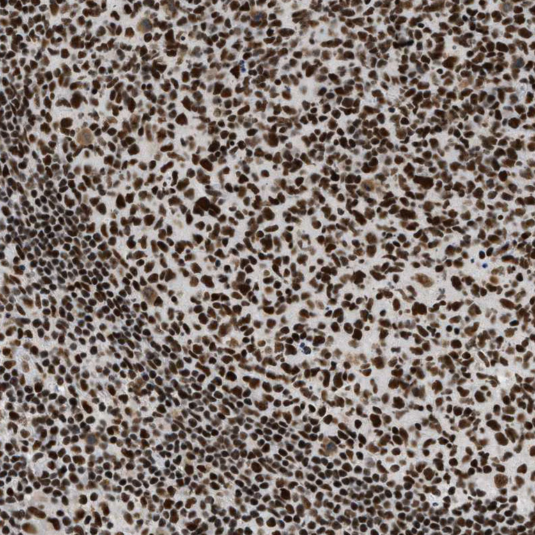 Immunohistochemistry (Formalin/PFA-fixed paraffin-embedded sections) - Anti-SMARCB1 Antibody (AB327193)