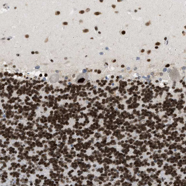 Immunohistochemistry (Formalin/PFA-fixed paraffin-embedded sections) - Anti-SMARCB1 Antibody (AB327193)