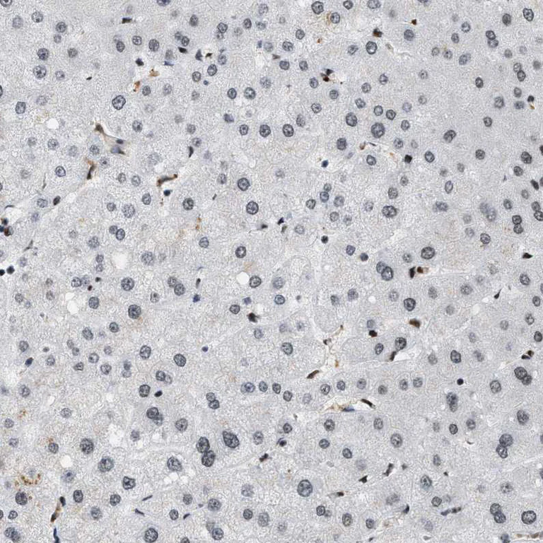 Immunohistochemistry (Formalin/PFA-fixed paraffin-embedded sections) - Anti-SMARCB1 Antibody (AB327193)