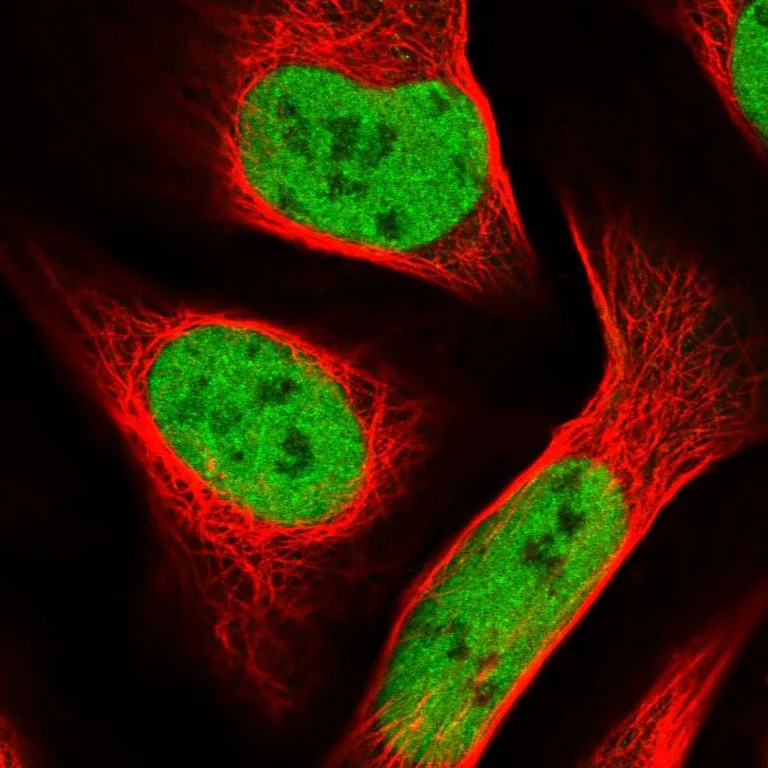 Immunocytochemistry/ Immunofluorescence - Anti-SMARCC1 Antibody (AB327207)
