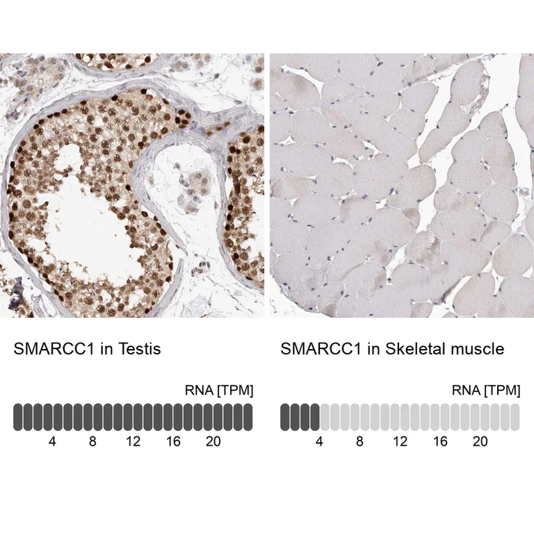 Immunohistochemistry (Formalin/PFA-fixed paraffin-embedded sections) - Anti-SMARCC1 Antibody (AB327207)