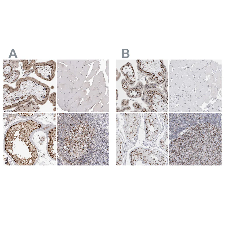 Immunohistochemistry (Formalin/PFA-fixed paraffin-embedded sections) - Anti-SMARCC1 Antibody (AB327207)