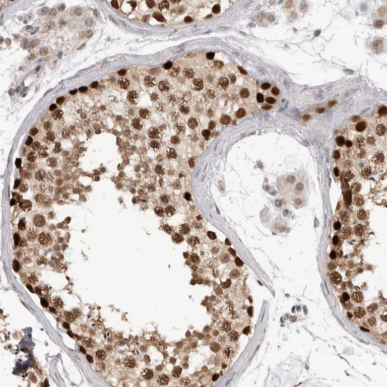 Immunohistochemistry (Formalin/PFA-fixed paraffin-embedded sections) - Anti-SMARCC1 Antibody (AB327207)