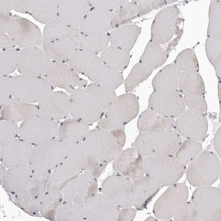 Immunohistochemistry (Formalin/PFA-fixed paraffin-embedded sections) - Anti-SMARCC1 Antibody (AB327207)