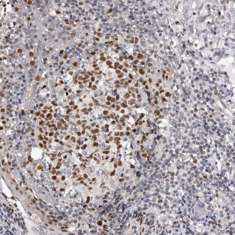 Immunohistochemistry (Formalin/PFA-fixed paraffin-embedded sections) - Anti-SMARCC1 Antibody (AB327207)