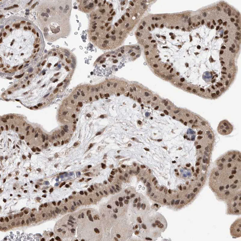 Immunohistochemistry (Formalin/PFA-fixed paraffin-embedded sections) - Anti-SMARCC1 Antibody (AB327207)
