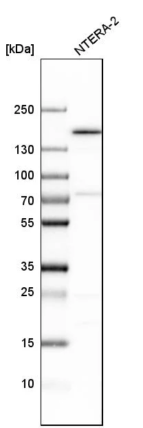 Western blot - Anti-SMARCC1 Antibody (AB327207)
