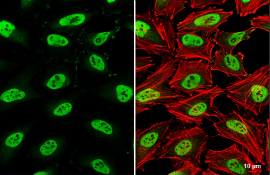 Immunocytochemistry/ Immunofluorescence - Anti-SMARCC1/BAF155 antibody (AB126180)