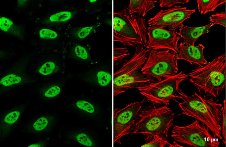 Immunocytochemistry/ Immunofluorescence - Anti-SMARCC1/BAF155 antibody (AB126180)