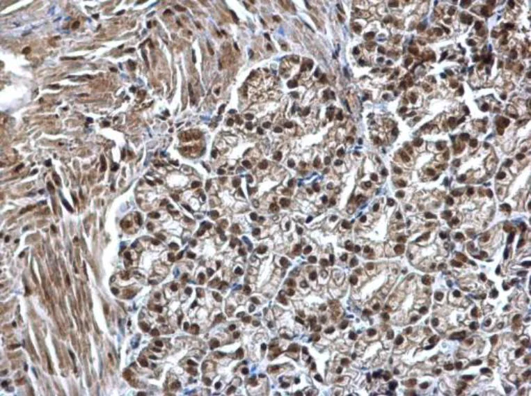 Immunohistochemistry (Formalin/PFA-fixed paraffin-embedded sections) - Anti-SMARCC1/BAF155 antibody (AB126180)