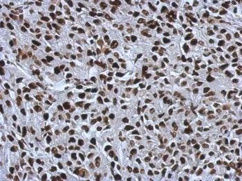 Immunohistochemistry (Formalin/PFA-fixed paraffin-embedded sections) - Anti-SMARCC1/BAF155 antibody (AB126180)