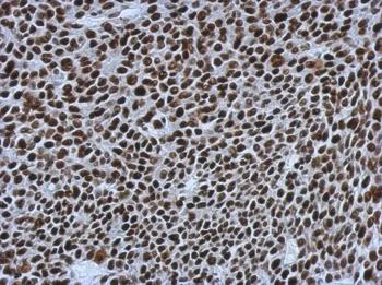 Immunohistochemistry (Formalin/PFA-fixed paraffin-embedded sections) - Anti-SMARCC1/BAF155 antibody (AB126180)