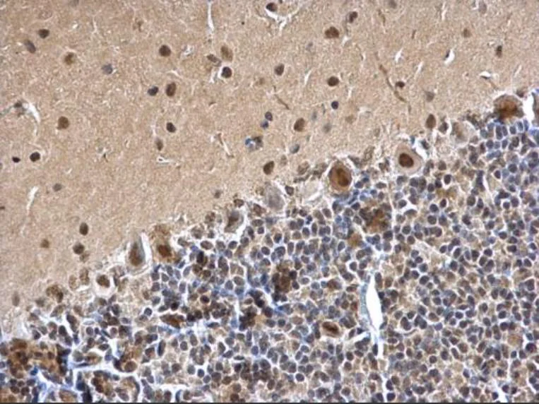 Immunohistochemistry (Formalin/PFA-fixed paraffin-embedded sections) - Anti-SMARCC1/BAF155 antibody (AB126180)