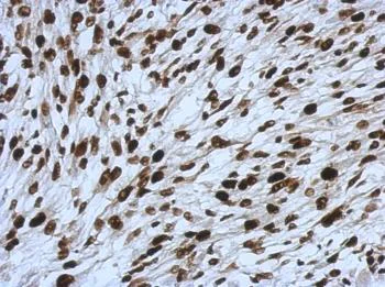Immunohistochemistry (Formalin/PFA-fixed paraffin-embedded sections) - Anti-SMARCC1/BAF155 antibody (AB126180)