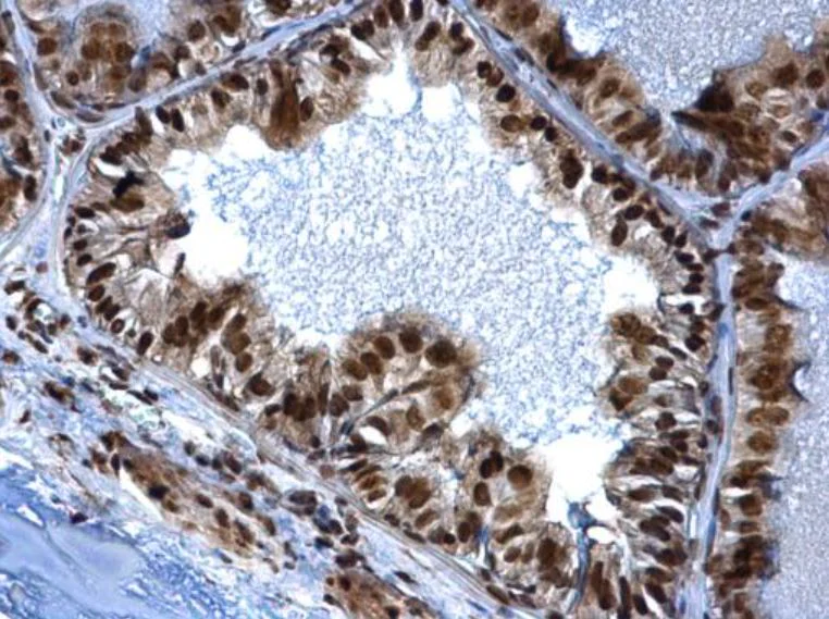 Immunohistochemistry (Formalin/PFA-fixed paraffin-embedded sections) - Anti-SMARCC1/BAF155 antibody (AB126180)