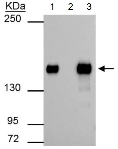 Immunoprecipitation - Anti-SMARCC1/BAF155 antibody (AB126180)