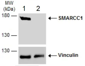 Western blot - Anti-SMARCC1/BAF155 antibody (AB126180)