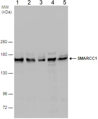 Western blot - Anti-SMARCC1/BAF155 antibody (AB126180)