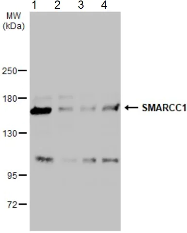 Western blot - Anti-SMARCC1/BAF155 antibody (AB126180)