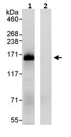 Immunoprecipitation - Anti-SMARCC1/BAF155 antibody (AB264166)