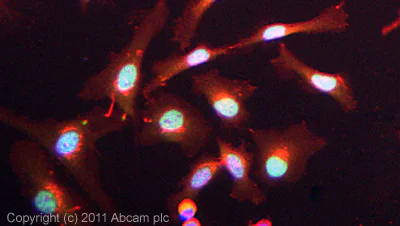 Immunocytochemistry/ Immunofluorescence - Anti-SMARCC1/BAF155 antibody (AB72503)
