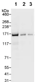 Western blot - Anti-SMARCC1/BAF155 antibody (AB72503)