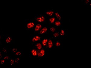 Immunocytochemistry/ Immunofluorescence - Anti-SMARCC1/BAF155 antibody [EPR12389] - BSA and Azide free (AB249725)