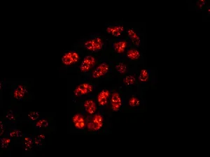 Immunocytochemistry/ Immunofluorescence - Anti-SMARCC1/BAF155 antibody [EPR12389] - BSA and Azide free (AB249725)