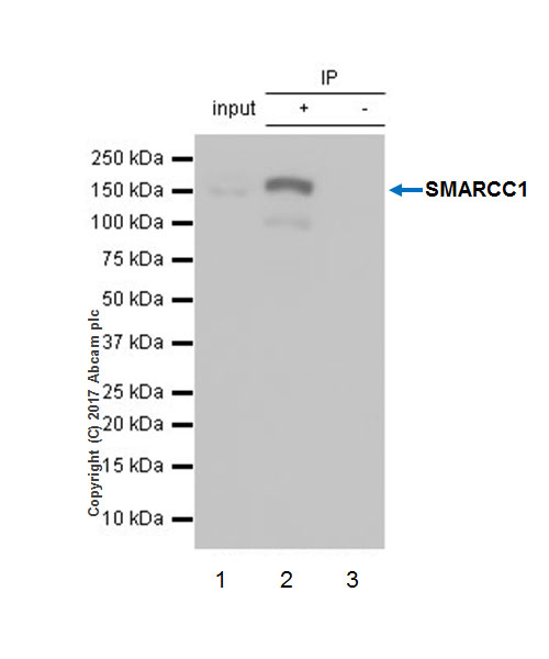 Immunoprecipitation - Anti-SMARCC1/BAF155 antibody [EPR12395] - ChIP Grade (ab172638), expandable thumbnail