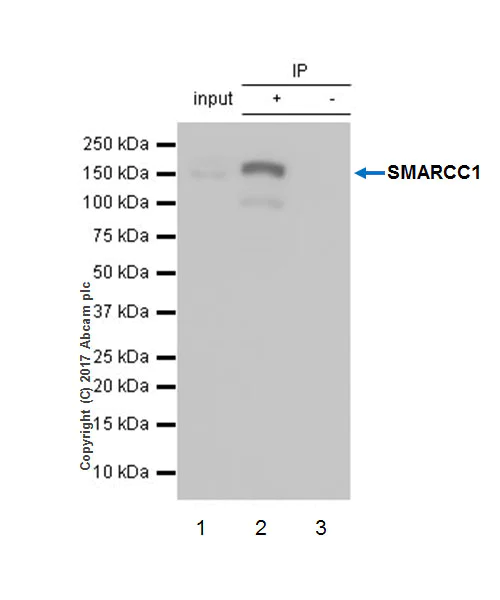 Immunoprecipitation - Anti-SMARCC1/BAF155 antibody [EPR12395] - ChIP Grade (AB172638)