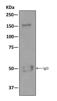Immunoprecipitation - Anti-SMARCC1/BAF155 antibody [EPR12395] - ChIP Grade (AB172638)