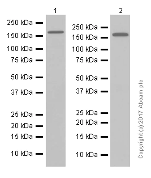 Western blot - Anti-SMARCC1/BAF155 antibody [EPR12395] - ChIP Grade (AB172638)
