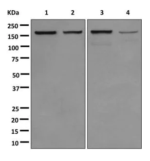 Western blot - Anti-SMARCC1/BAF155 antibody [EPR12395] - ChIP Grade (AB172638)