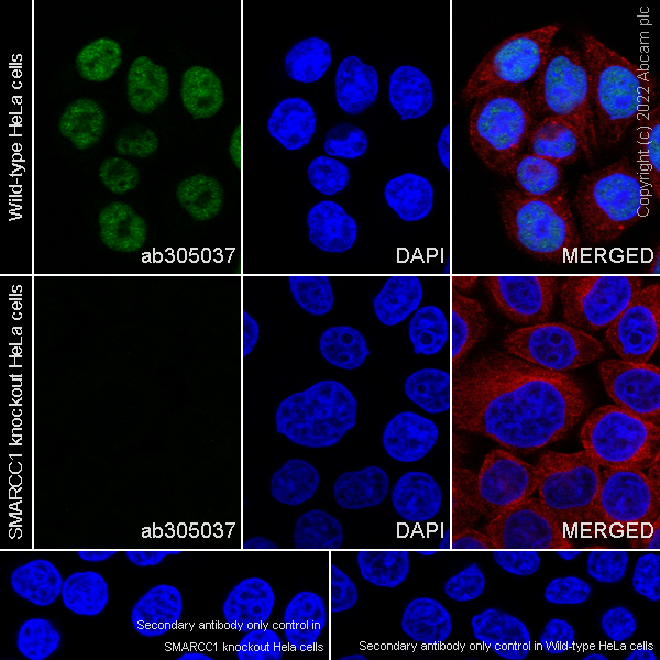 Immunocytochemistry/ Immunofluorescence - Anti-SMARCC1/BAF155 antibody [EPR25109-77] (ab305037), expandable thumbnail