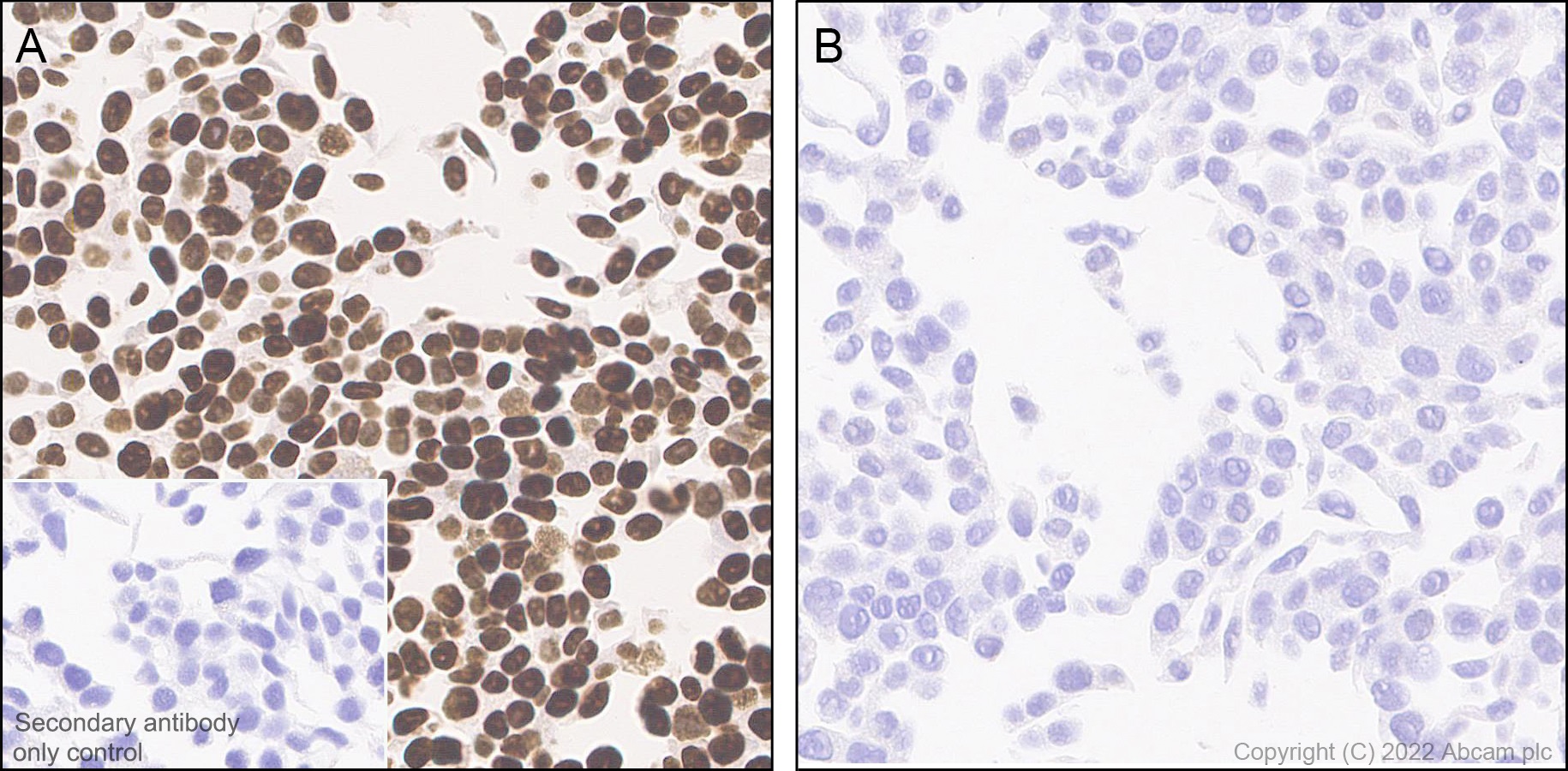 Immunohistochemistry (Formalin/PFA-fixed paraffin-embedded sections) - Anti-SMARCC1/BAF155 antibody [EPR25109-77] (ab305037), expandable thumbnail