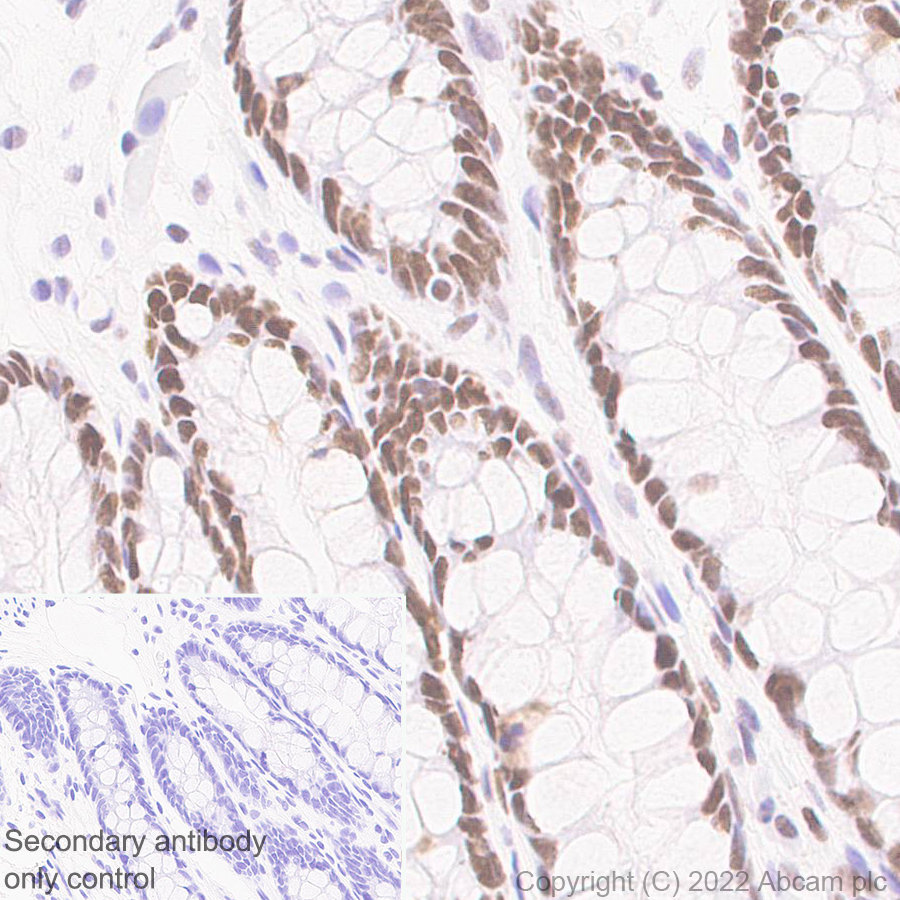Immunohistochemistry (Formalin/PFA-fixed paraffin-embedded sections) - Anti-SMARCC1/BAF155 antibody [EPR25109-77] (ab305037), expandable thumbnail