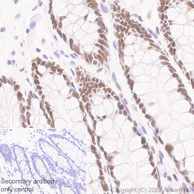 Immunohistochemistry (Formalin/PFA-fixed paraffin-embedded sections) - Anti-SMARCC1/BAF155 antibody [EPR25109-77] (AB305037)