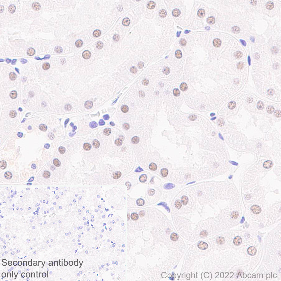 Immunohistochemistry (Formalin/PFA-fixed paraffin-embedded sections) - Anti-SMARCC1/BAF155 antibody [EPR25109-77] (ab305037), expandable thumbnail