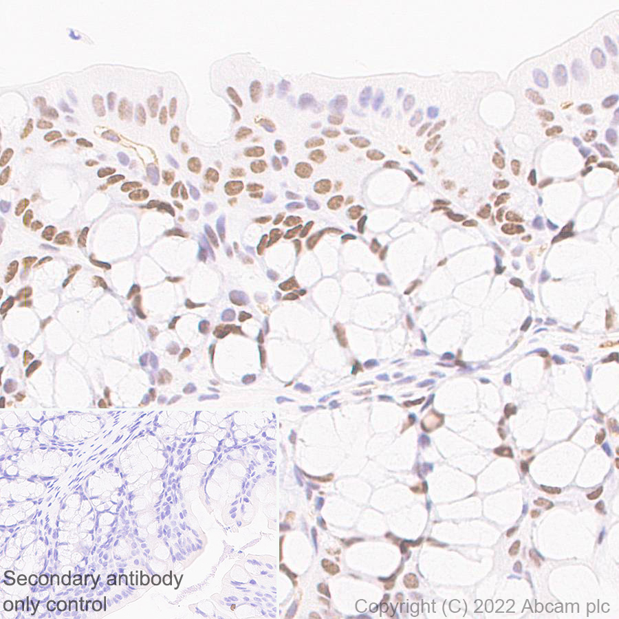 Immunohistochemistry (Formalin/PFA-fixed paraffin-embedded sections) - Anti-SMARCC1/BAF155 antibody [EPR25109-77] (ab305037), expandable thumbnail
