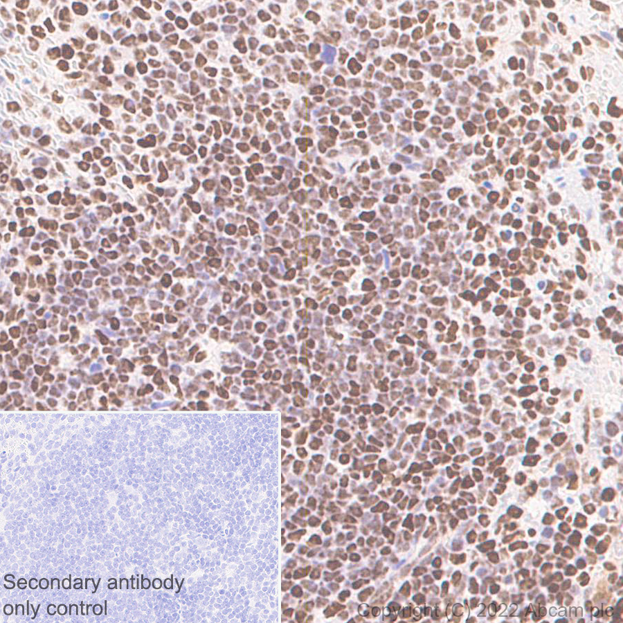 Immunohistochemistry (Formalin/PFA-fixed paraffin-embedded sections) - Anti-SMARCC1/BAF155 antibody [EPR25109-77] (ab305037), expandable thumbnail