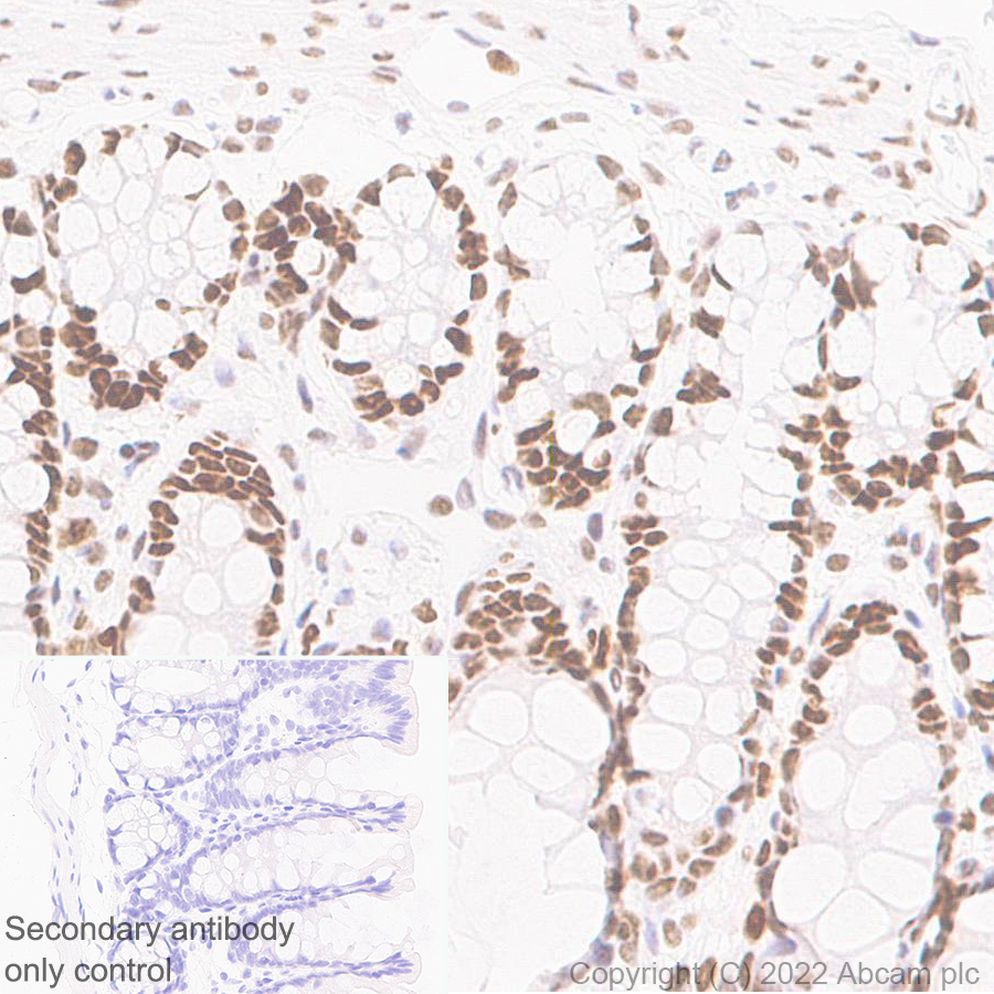 Immunohistochemistry (Formalin/PFA-fixed paraffin-embedded sections) - Anti-SMARCC1/BAF155 antibody [EPR25109-77] (ab305037), expandable thumbnail