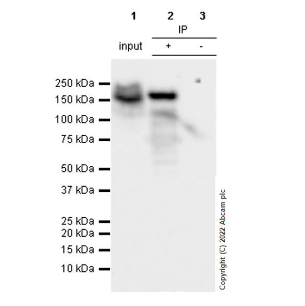 Immunoprecipitation - Anti-SMARCC1/BAF155 antibody [EPR25109-77] (AB305037), expandable thumbnail