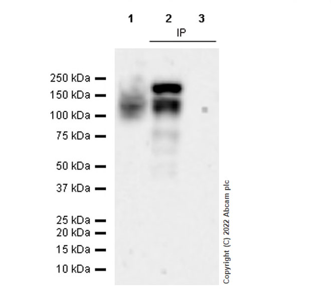 Immunoprecipitation - Anti-SMARCC1/BAF155 antibody [EPR25109-77] (AB305037), expandable thumbnail