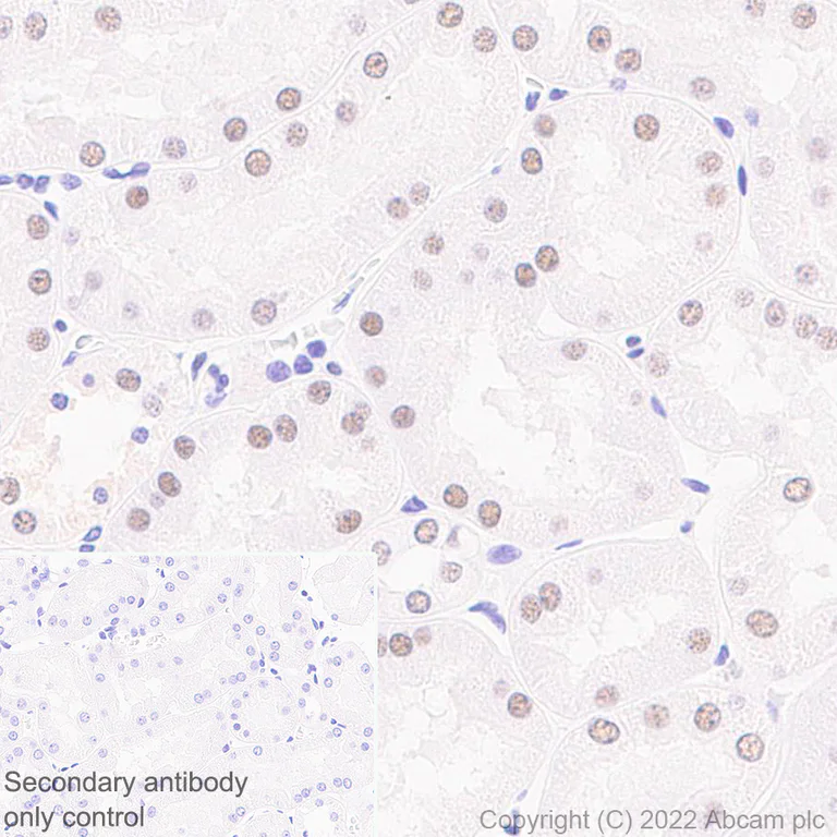 Immunohistochemistry (Formalin/PFA-fixed paraffin-embedded sections) - Anti-SMARCC1/BAF155 antibody [EPR25109-77] - BSA and Azide free (AB305038)