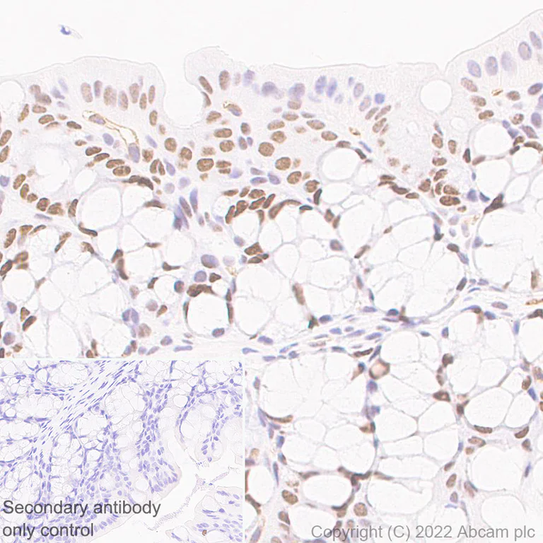 Immunohistochemistry (Formalin/PFA-fixed paraffin-embedded sections) - Anti-SMARCC1/BAF155 antibody [EPR25109-77] - BSA and Azide free (AB305038)